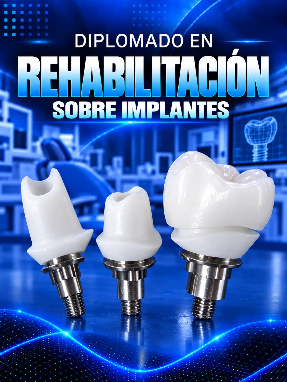Diplomado en Rehabilitación sobre Implantes