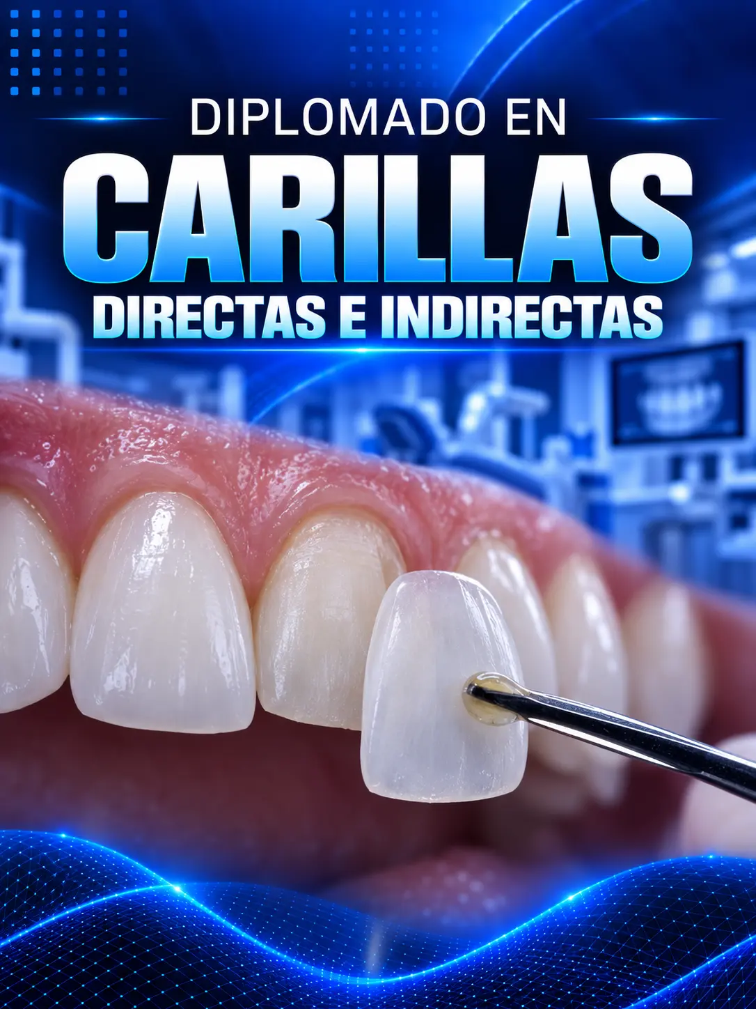 Diplomado en Carillas Directas e Indirectas