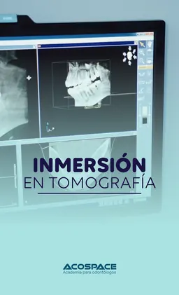 Tomografia