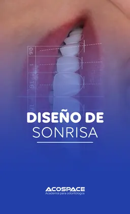 Diseño De Sonrisa