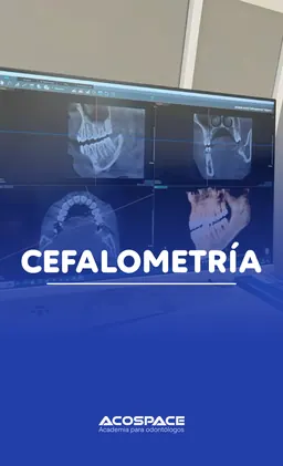 Cefalometria