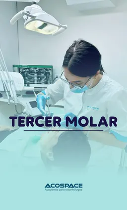 Tercer Molar